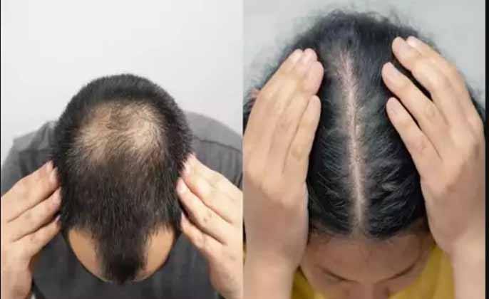10 Best Hair Loss Doctors in Dhaka